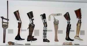 Types of Prosthetic Leg