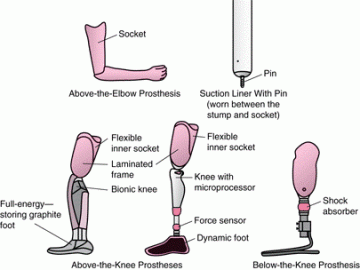 Prosthesis Leg Types Types of Prosthetic Leg – Prosthetics Blog